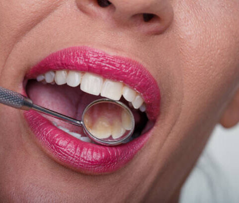 cosmetic dentist Adelaide