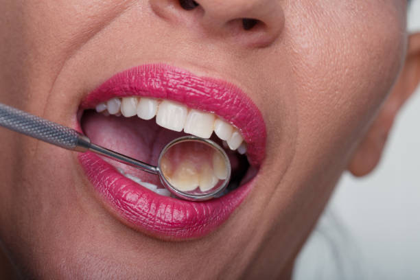 cosmetic dentist Adelaide