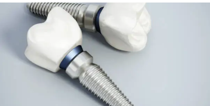 dental implants Adelaide